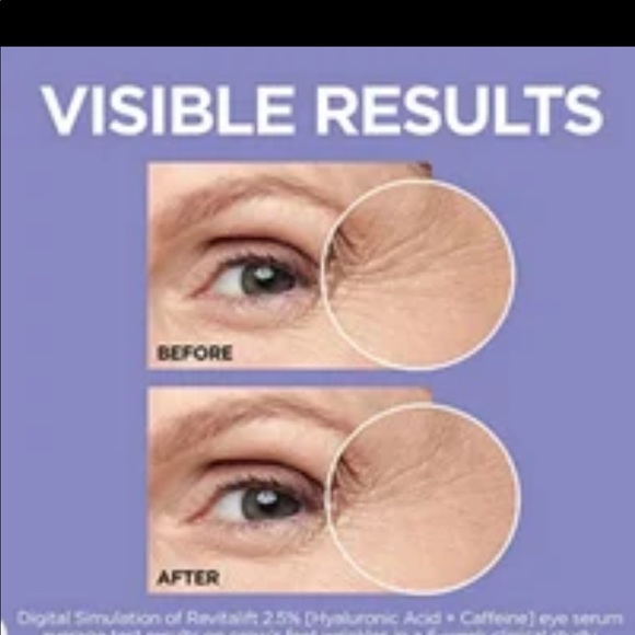 L'Oreal Paris Revitalift Derm Intensives Hyaluronic Acid and Caffeine Eye Serum - Picture 4 of 14